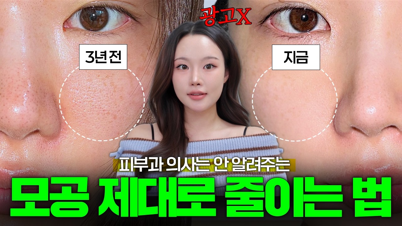 왜 아직도 모공 넓으세요..? 확 커진 모공도 작아보이게 만드는 실전 꿀팁, 꼼수 대방출