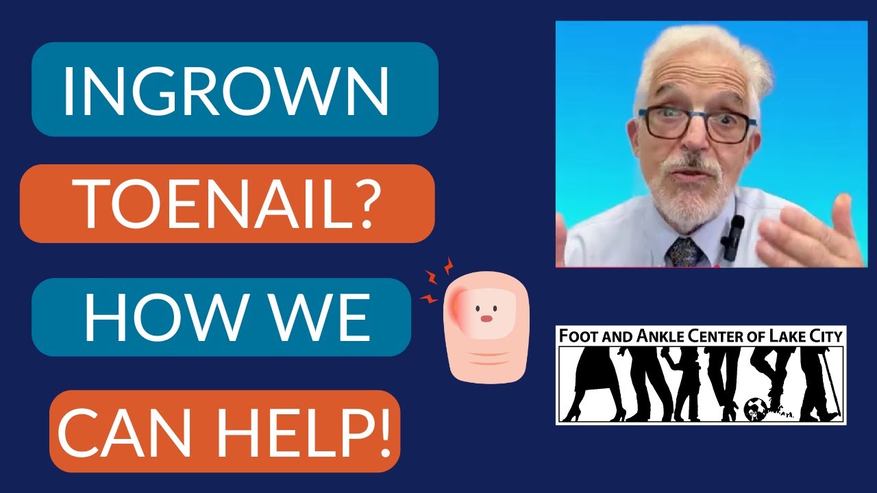 Ingrown Toenail? Here's How We Can Help!