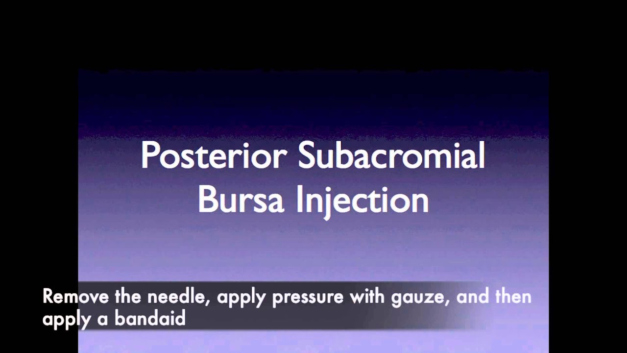 SdMskProject Shoulder Subacromial Injection