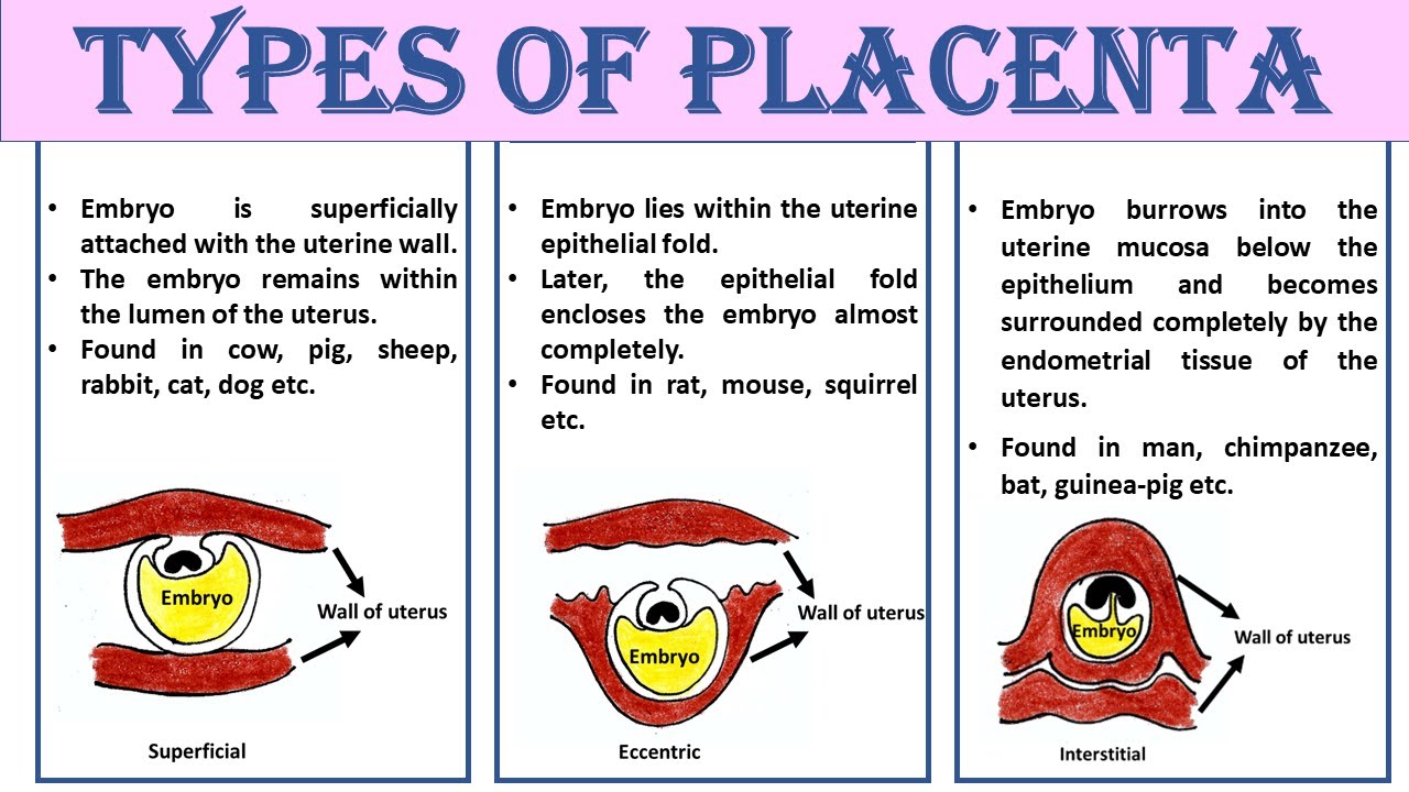 Types of placenta
