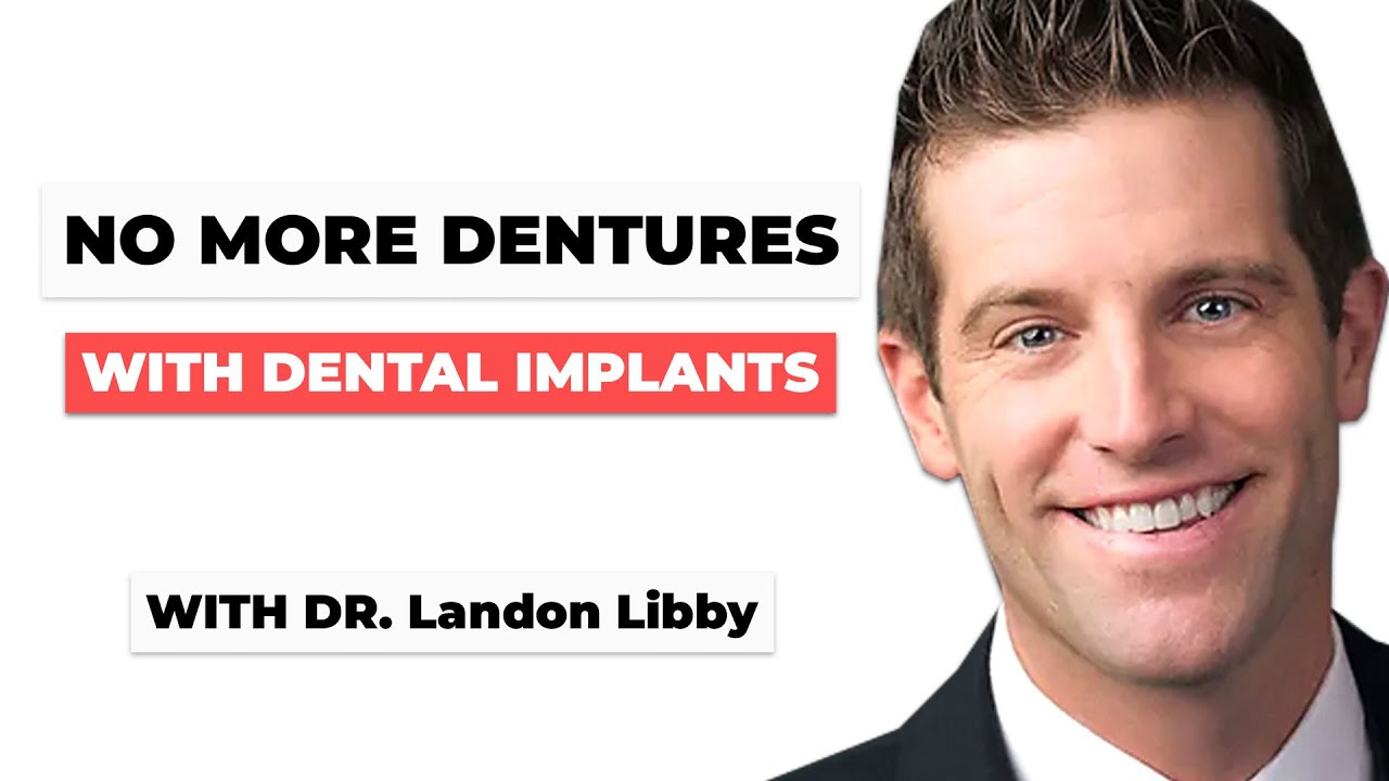 Replacing Missing Teeth with Dental Implants with Dr. Landon Libby – San Diego Dentist