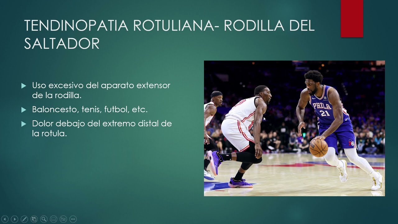 ECOGRAFIA DE LA RODILLA HALLAZGOS PATOLOGICOS EN LA CARA ANTERIOR