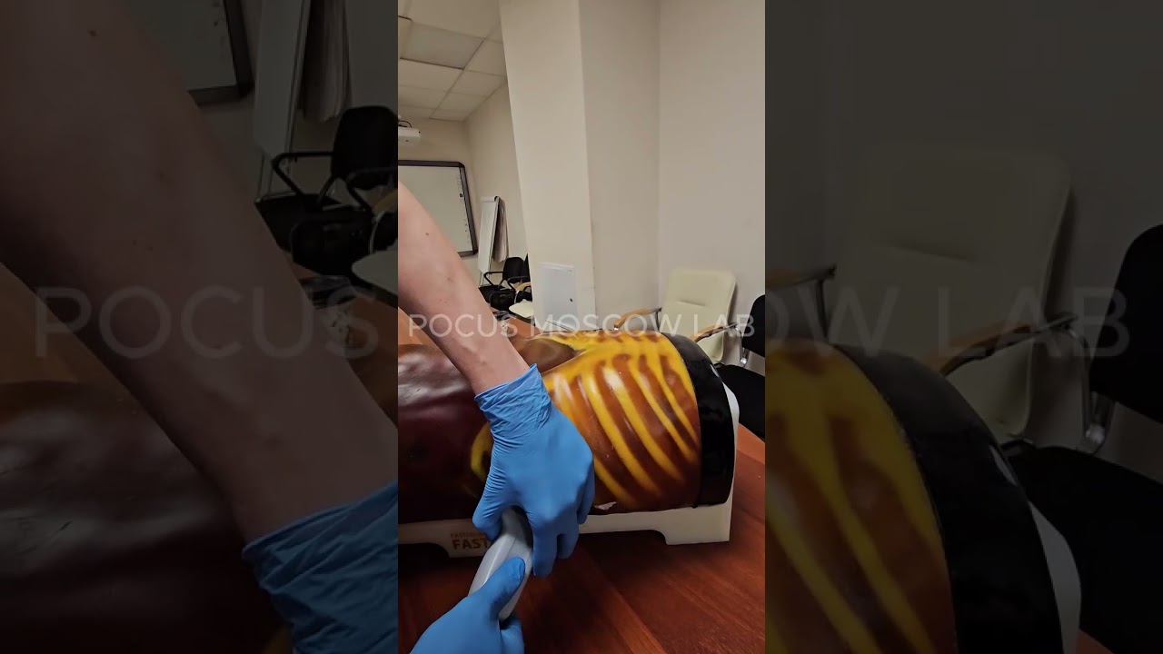 3D АНЕСТЕЗИОЛОГА-РЕАНИМАТОЛОГА СТАНЦИЯ: 1 Диагностика eFAST