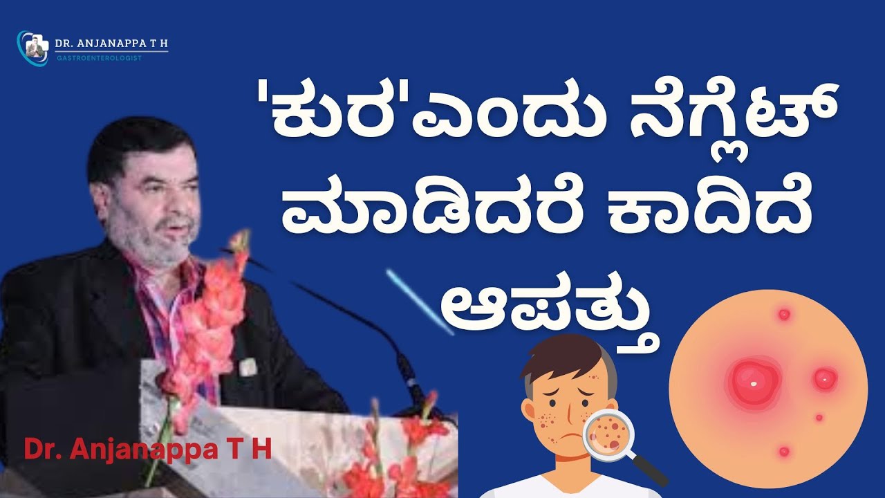 'ಕುರ'ಎಂದು ನೆಗ್ಲೆಟ್ ಮಾಡಿದರೆ ಕಾದಿದೆ ಆಪತ್ತು Furuncles and Carbuncles - Dr. Anjanappa