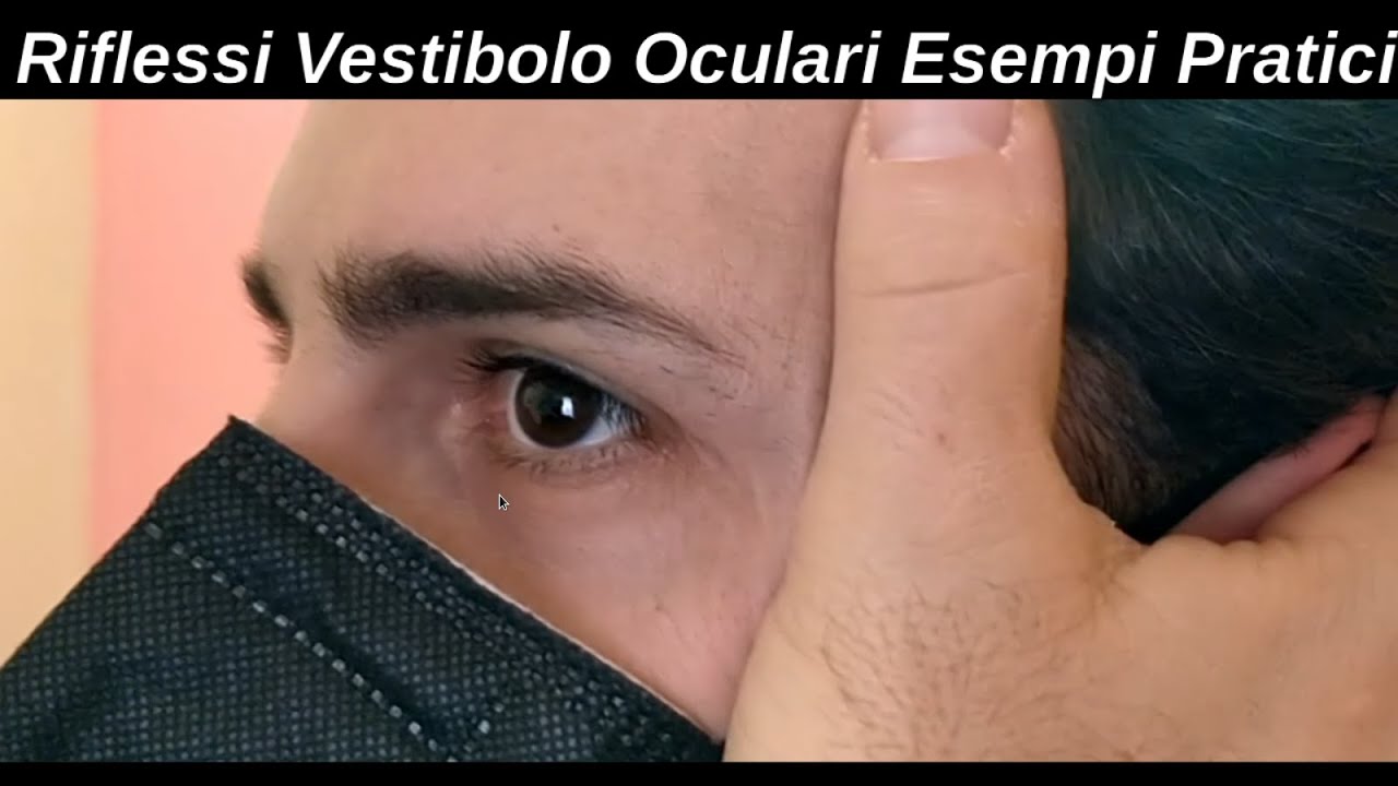 Riflessi Vestibolo Oculari: esempi pratici