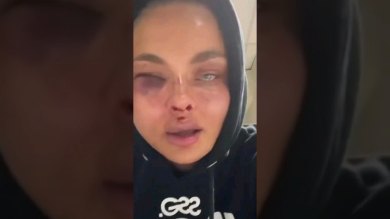 Women after fight Fame MMA 