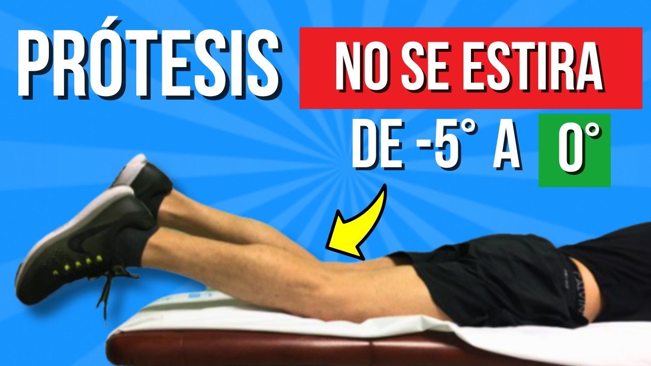 Rodilla RÍGIDA después de la PRÓTESIS: cómo recuperar la EXTENSIÓN completa (0 grados)