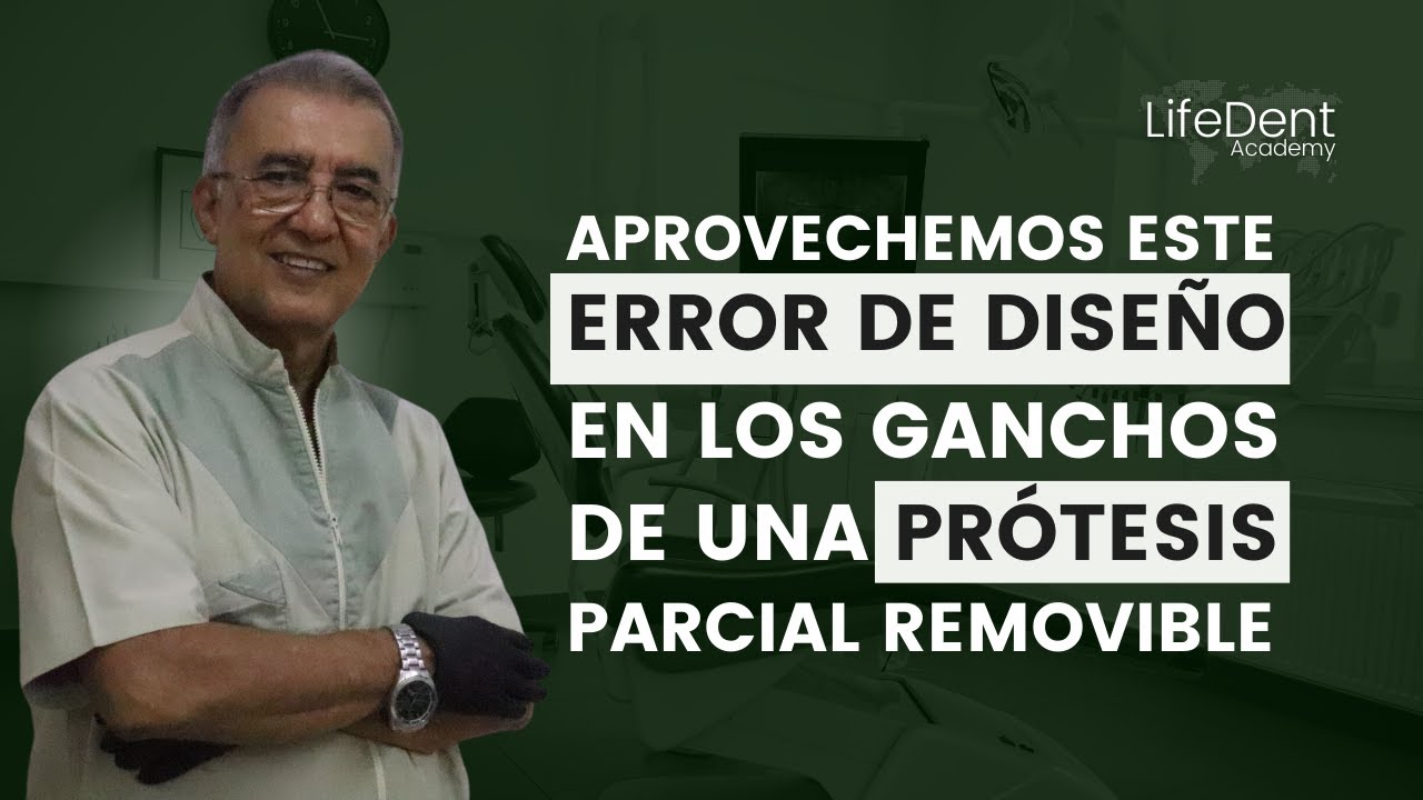 Aprovechemos este ERROR de diseño en los GANCHOS de una PPR. Junto al Dr. Alfredo Quintero