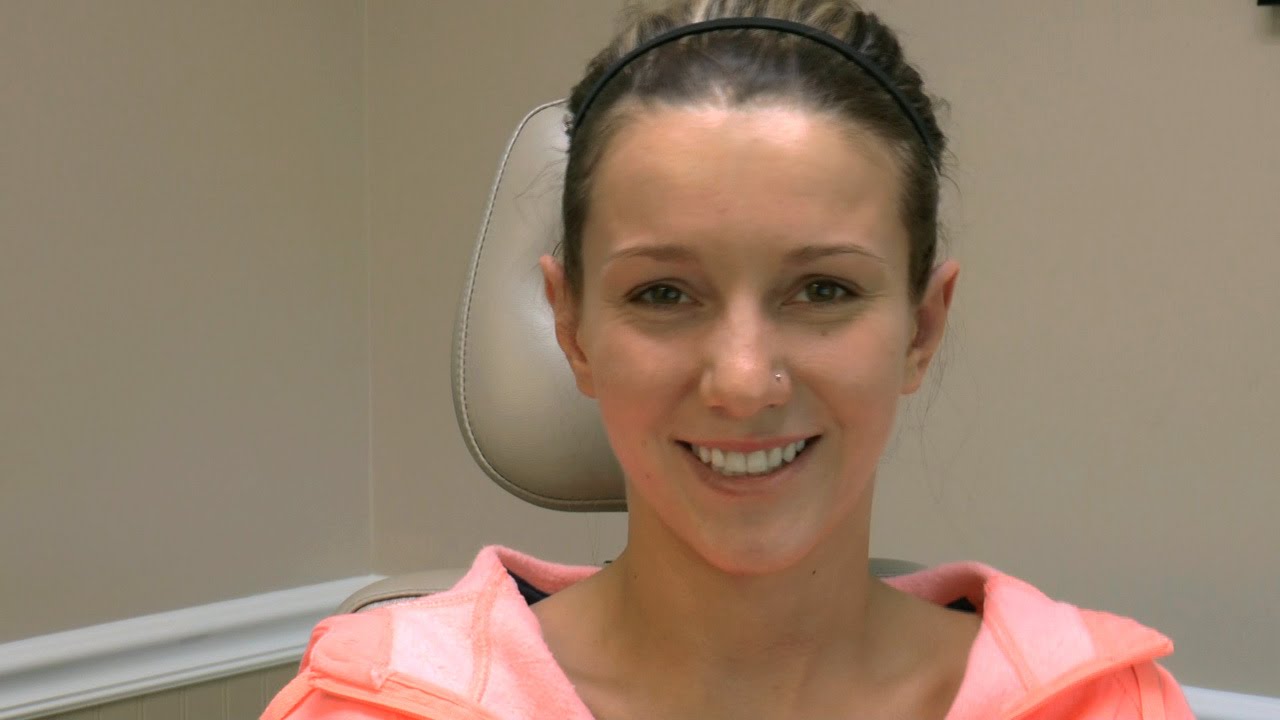 6 DAYS AFTER OTOPLASTY - DR. TANVEER JANJUA - NEW JERSEY