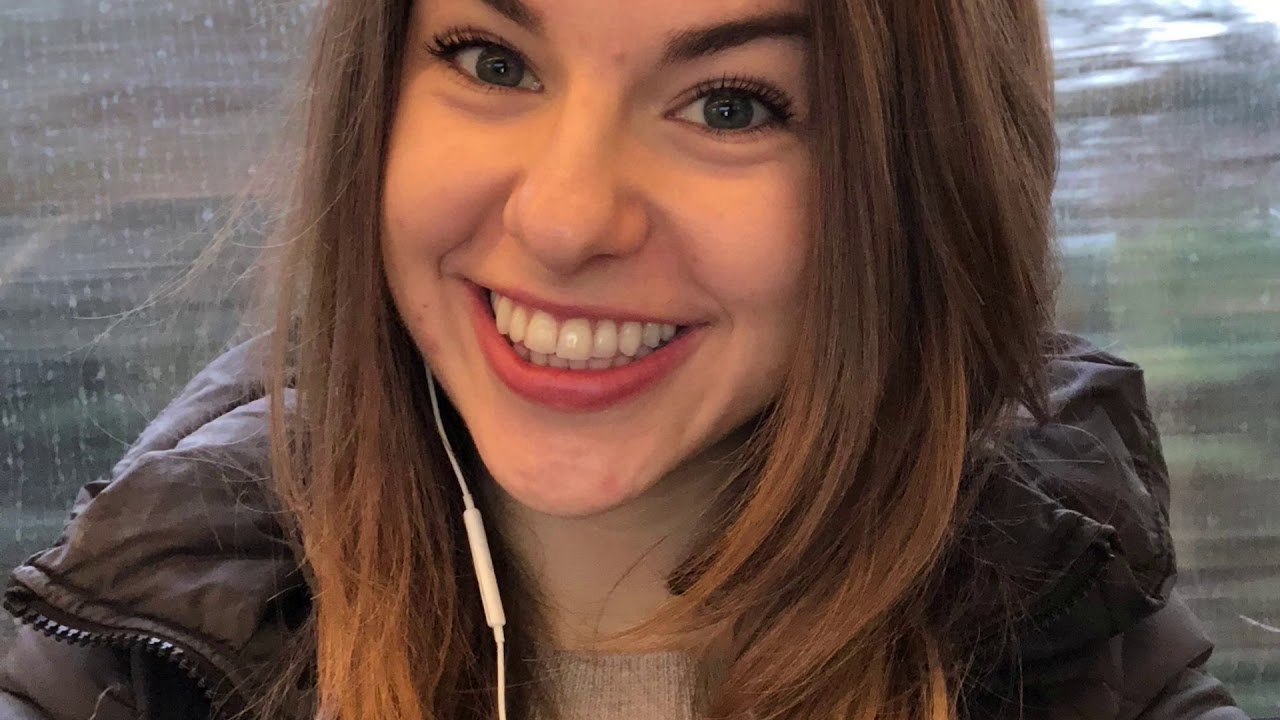 My Alopecia Story (with Pictures) - Alo Jules