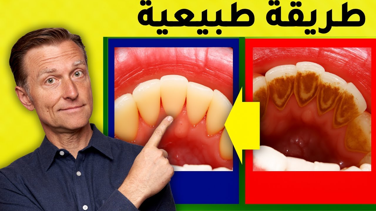 حل طبيعي لجير الأسنان والتسوس ومشاكل اللثة