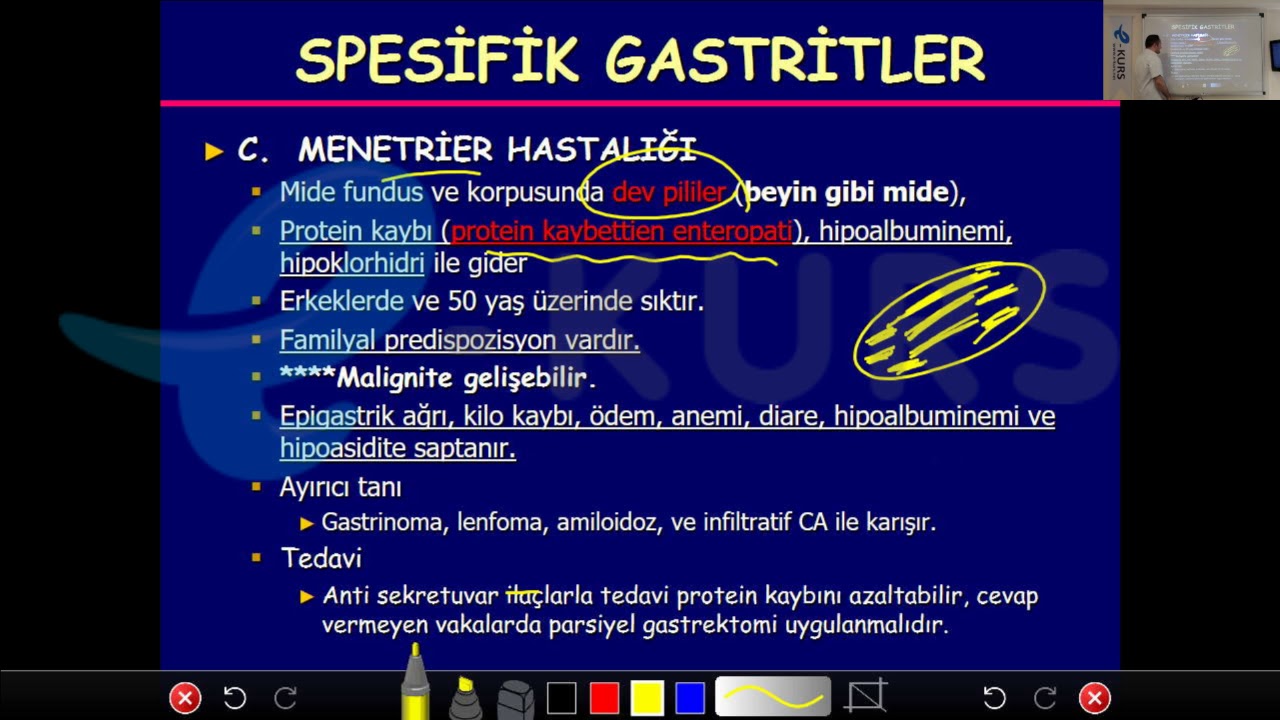 Online TUS Dersleri - Dahiliye - Gastrit / Akut, Kronik, Spesifik Gastrit, Helicobakter Pylori