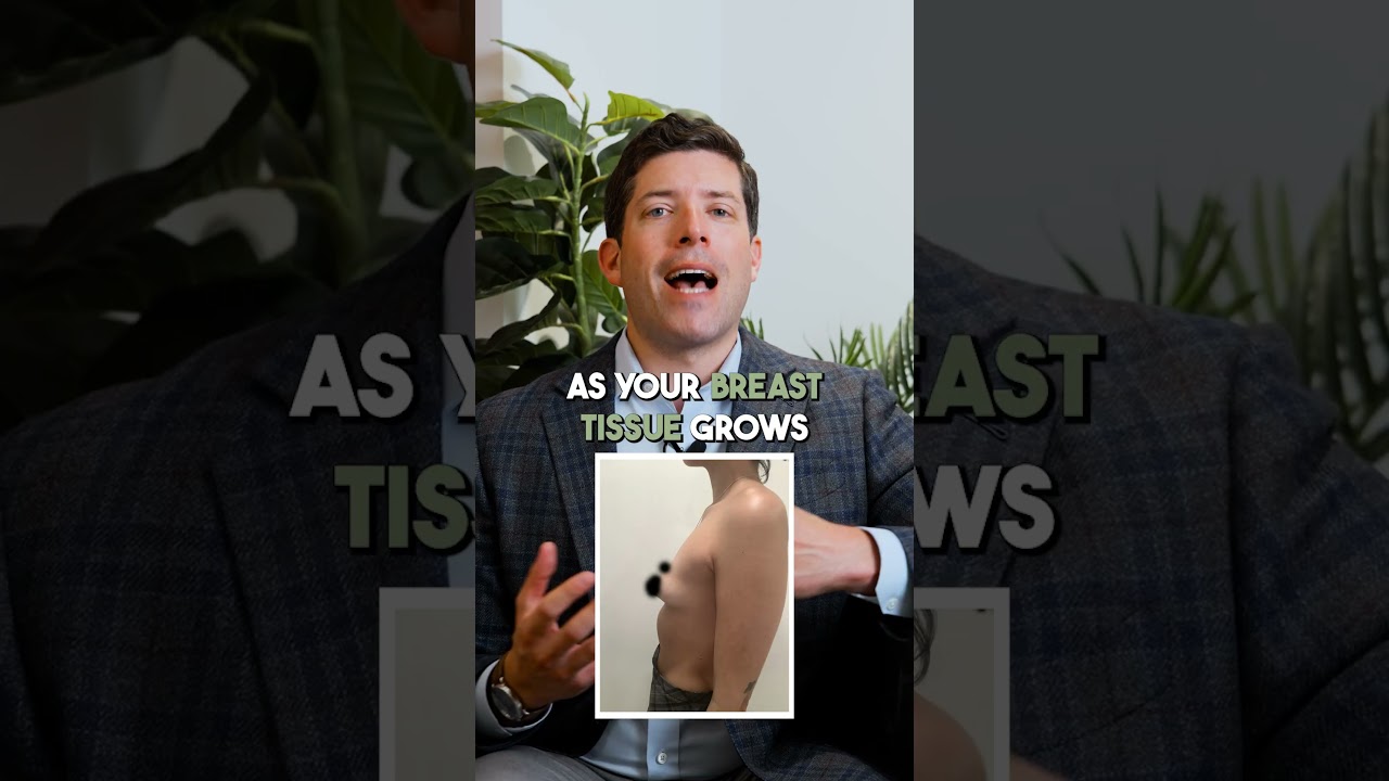 What Causes Tuberous Breasts?