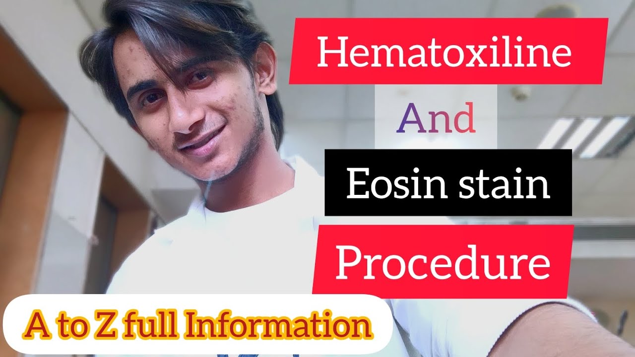 Hematoxyline and Eosin stain procedure!! How can you Do H & E Stain 😦