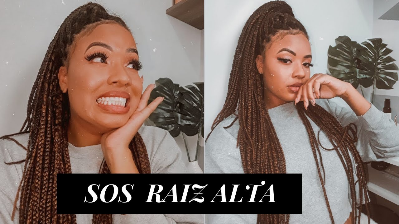 COMO SOBREVIVER COM A RAIZ ALTA DAS #BOXBRAIDS | Emanuelly Magal