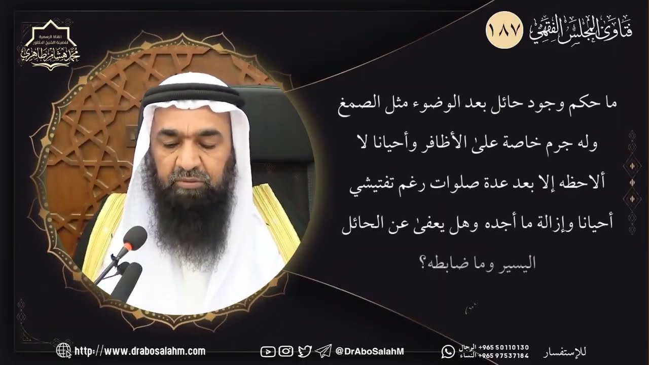 ما حكم وجود حائل بعد الوضوء مثل الصمغ وله جرم خاصة على الأظافر وأحيانا لا ألاحظه إلا بعد عدة صلوات