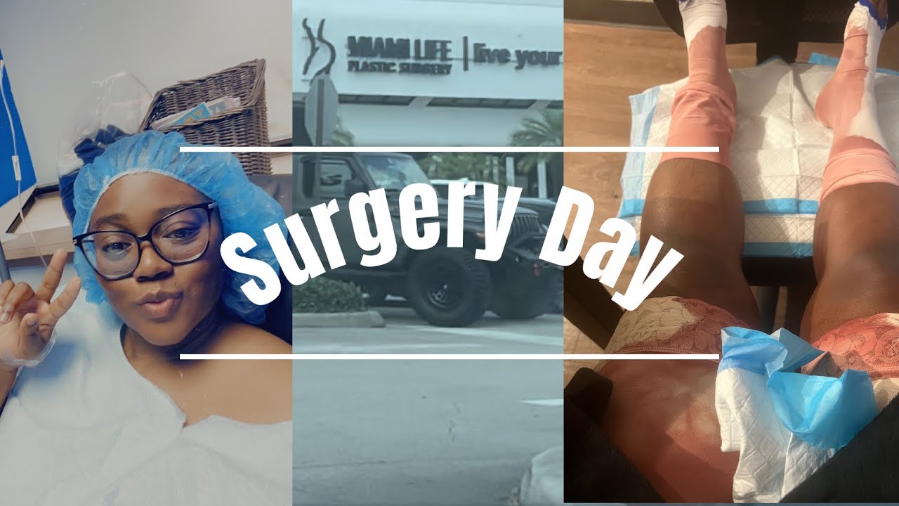 Surgery Vlog: 💉🩸lipo360|Dr.Nassif| Miami Life| Do I Hate my results?