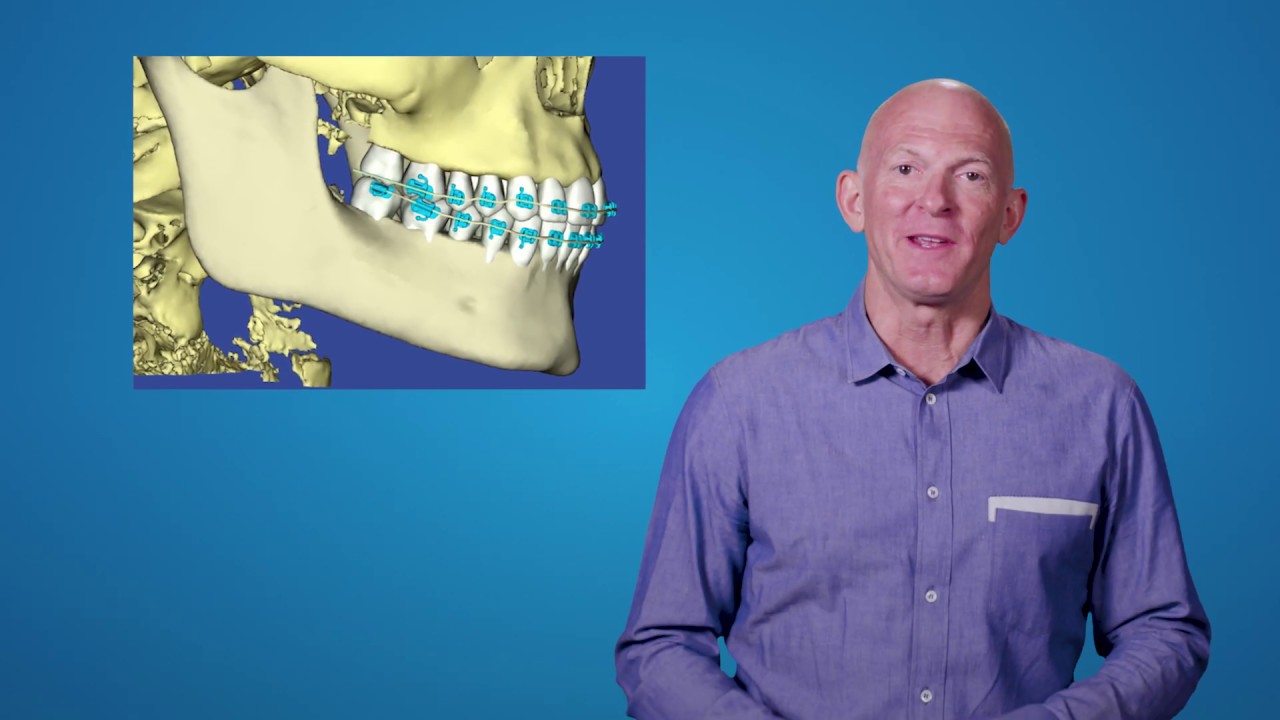 Suresmile Technology