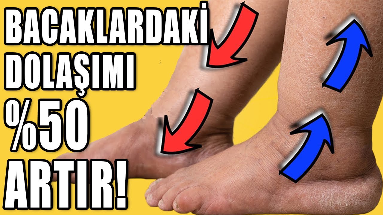 BACAKLARINDAKİ DOLAŞIMI %50 ARTIR! #aktifizyo #fiziktedavi #varistedavisi