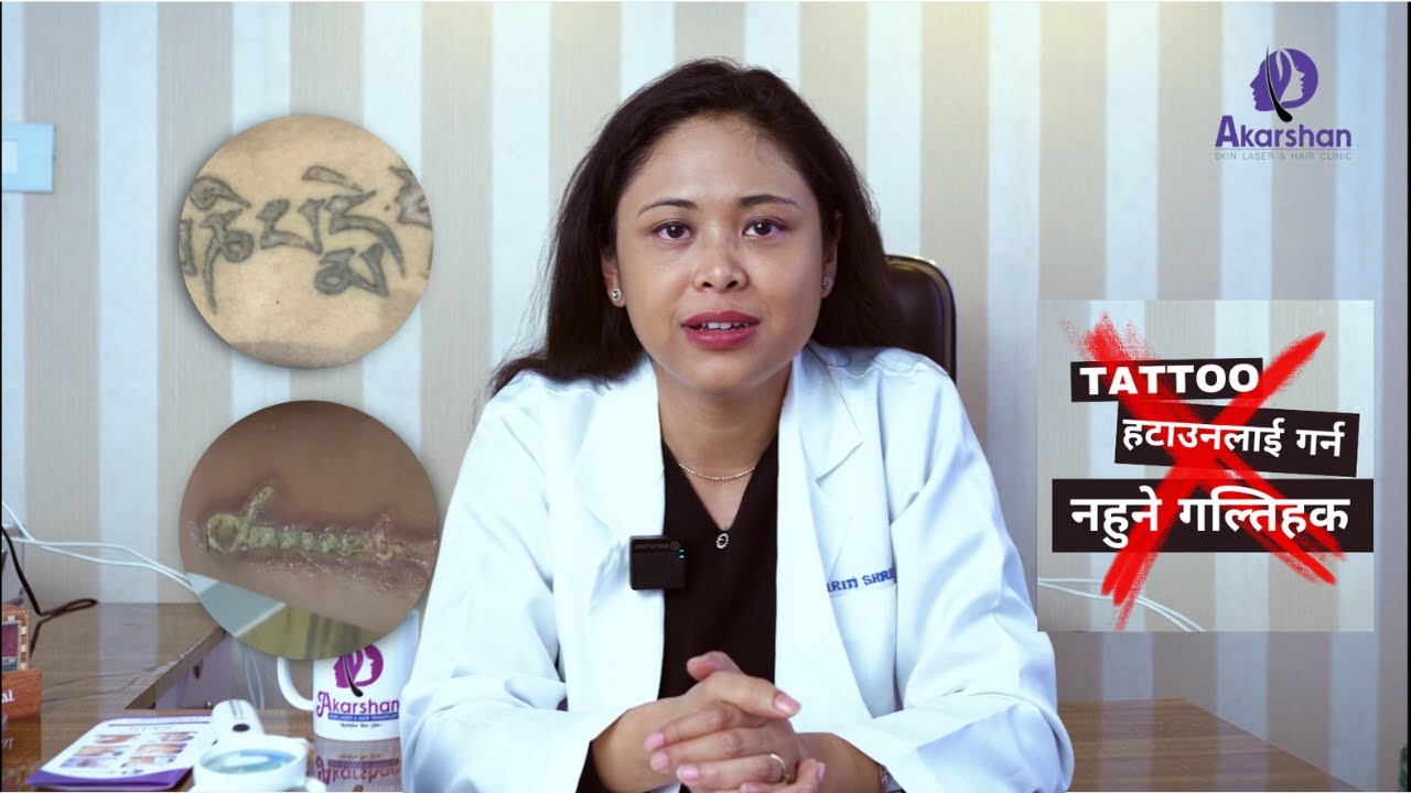 TATTOO हटाउनलाई गर्न नहुने गल्तिहक | TO REMOVE TATTOO DONT DO THIS MIATAKE