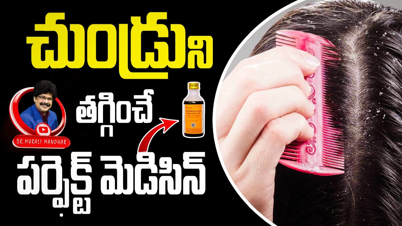 చుండ్రును తగ్గించే పర్ఫెక్ట్ మెడిసిన్ |10 Home Remedies to Get Rid of Dandruff Naturally| 
