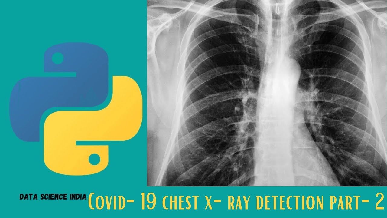 #2 COVID-19 CHEST X-RAY DETECTION USING TRANSFER LEARNING PART-2 | HINDI | DEEP LEARNING
