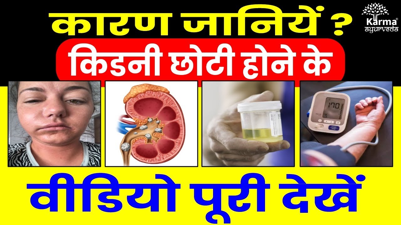 किडनी छोटी होने के कारण क्या है? | Causes of kidney shrinkage | kidney treatment | karma ayurveda