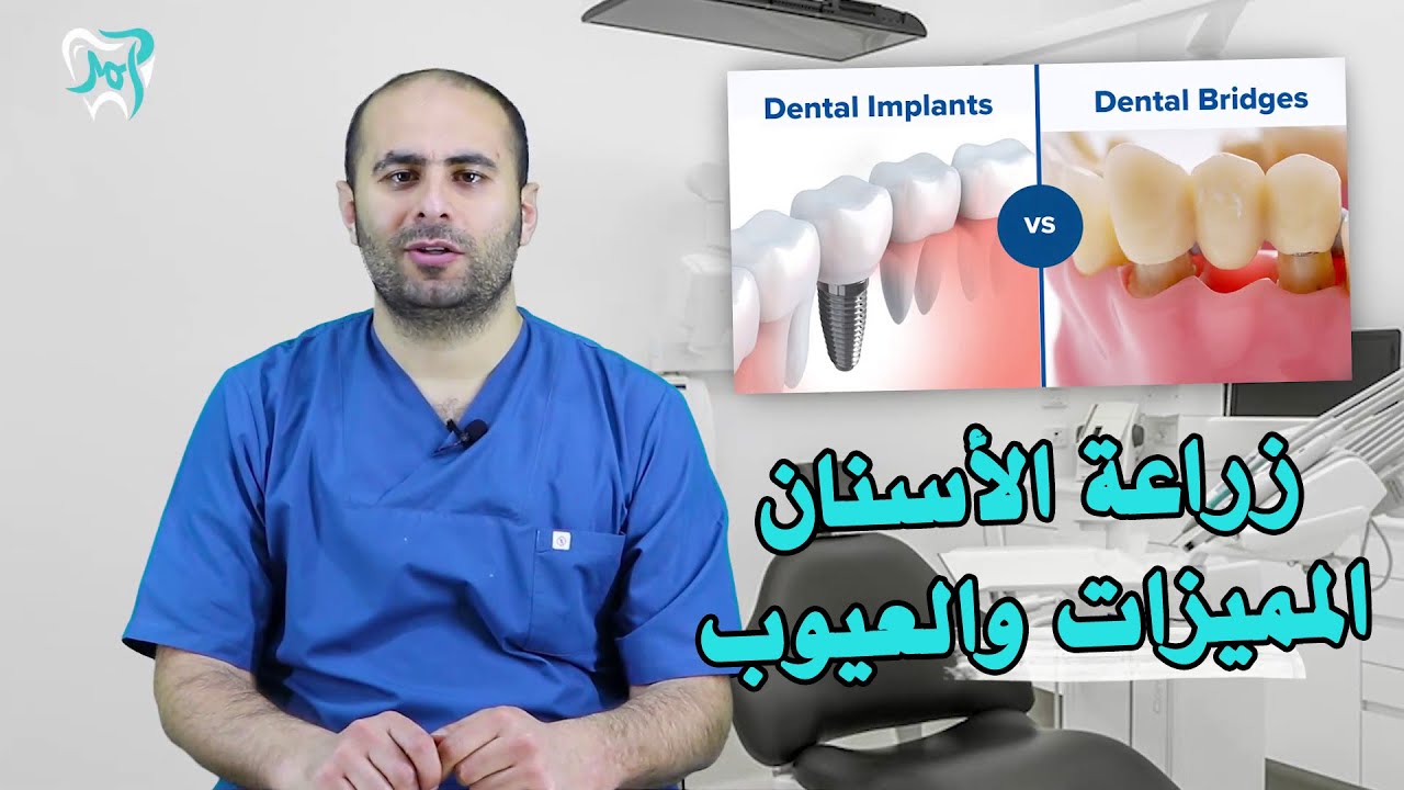 زراعة الأسنان بين المميزات والعيوب