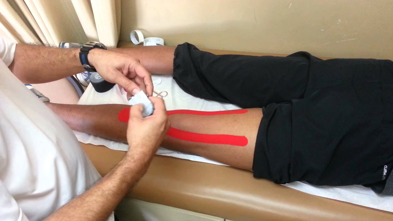 Kinesio taping for knee fossa popliteal