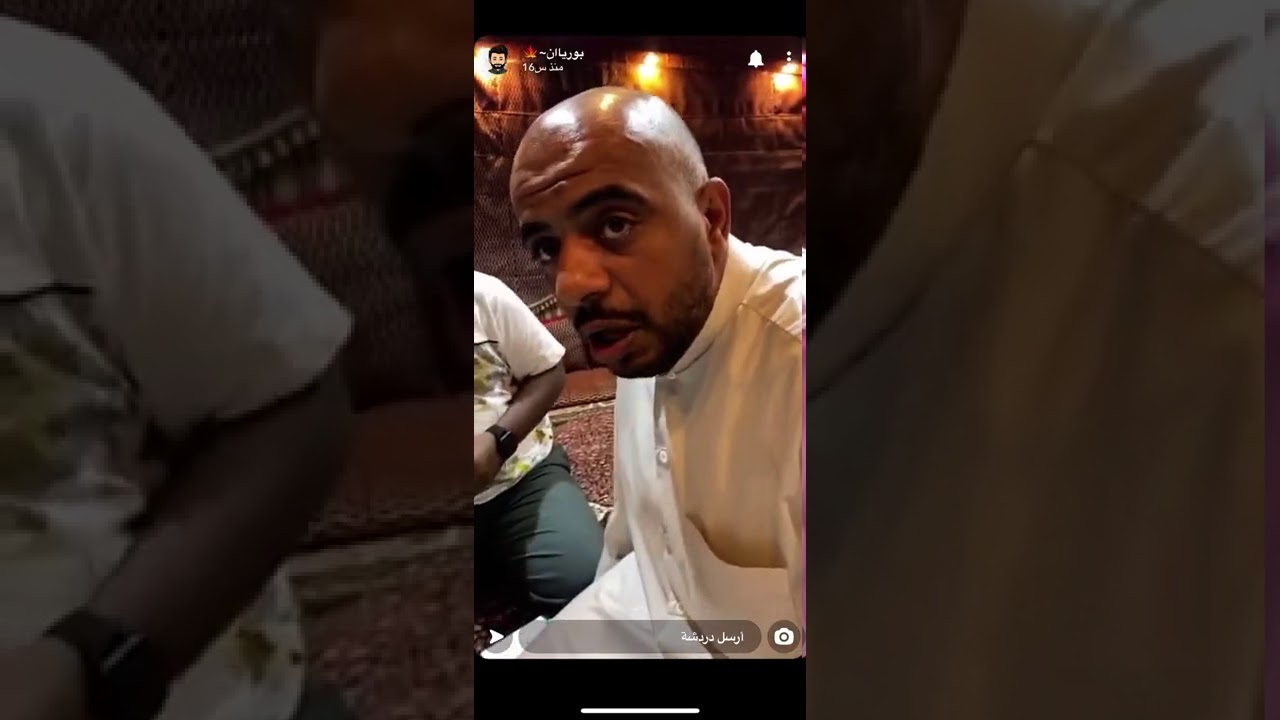 تم زراعة شعره 😎❤️