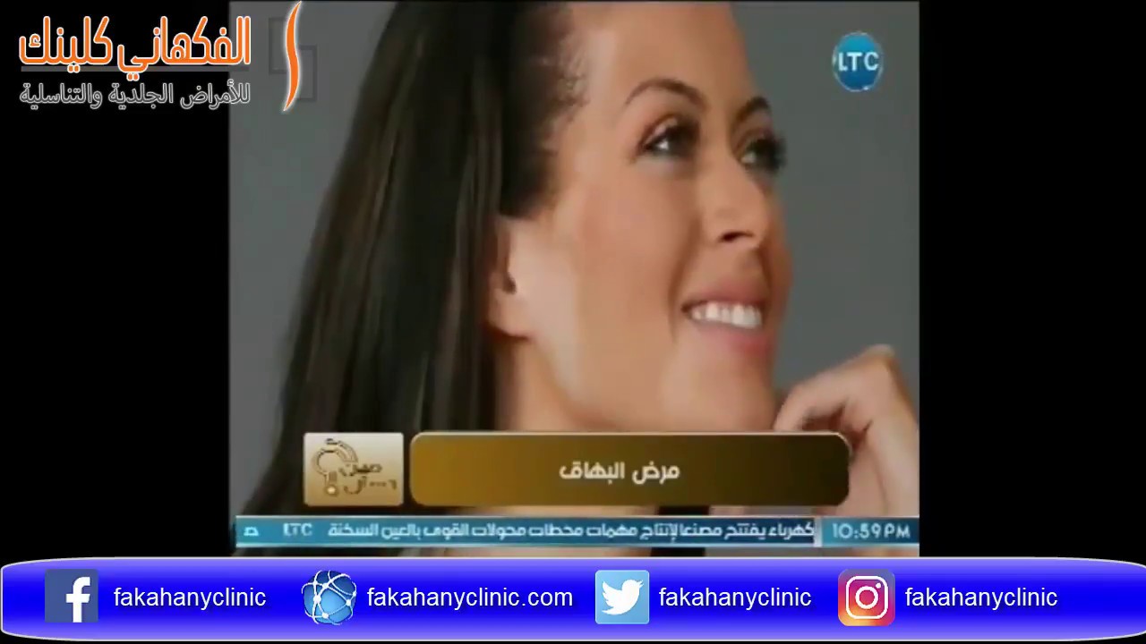 احدث علاج للبهاق فى مصر مع دكتور حسن الفكهاني في برنامج تسأل مين الموسم الثاني - ح 6