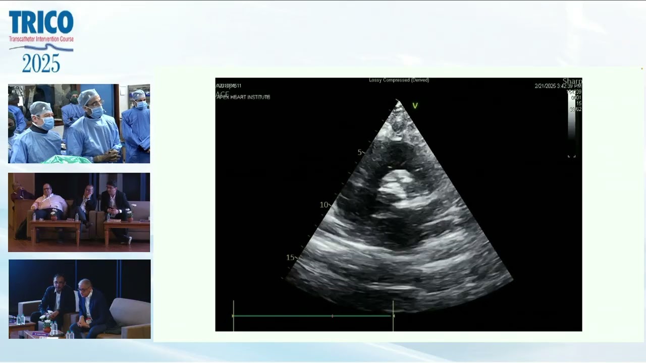 Mastering TAVR: Live Case by Dr. Aman Patel, Dr. Sanjay Shah & Dr. Abdurashid | TRICO 2025
