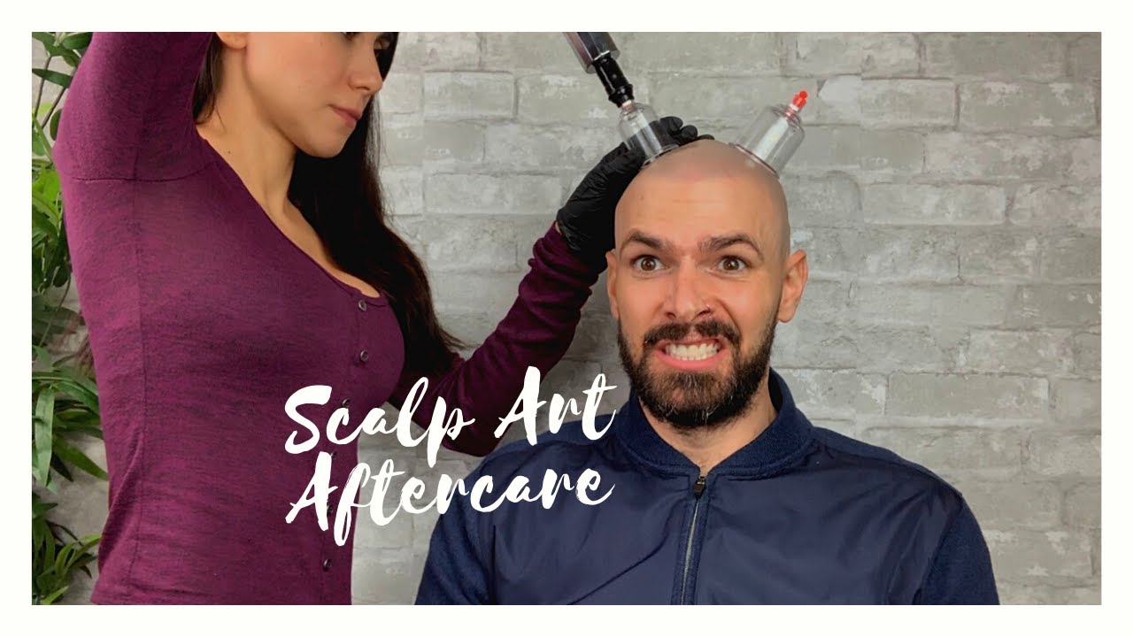 Scalp Micro-pigmentation Aftercare | SMP Aftercare Treatment | Scalp Art Aftercare |