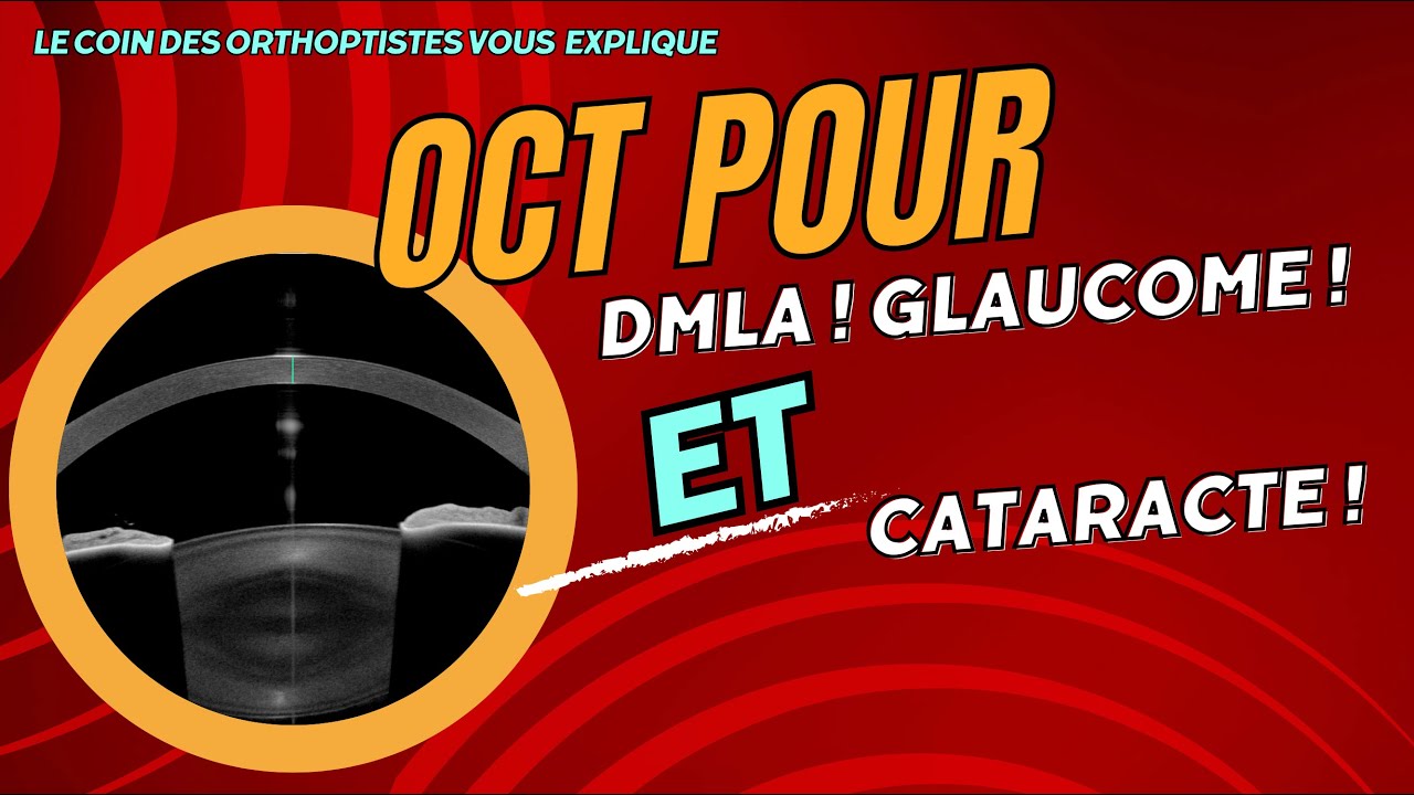 Pourquoi faire un OCT ?  pour le Glaucome, la DMLA, la Cataracte (Ophtalmologie /Orthoptie)