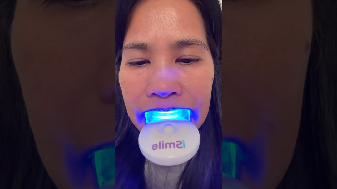 iSmile LED Light Activated Whitening Teeth kit #ismile  #whitening