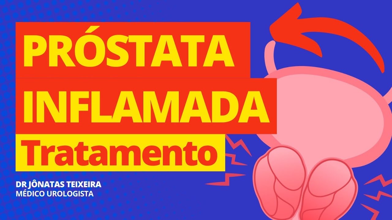 PR&Oacute;STATA INFLAMADA: TRATAMENTO | REM&Eacute;DIOS (UROLOGISTA RESPONDE)