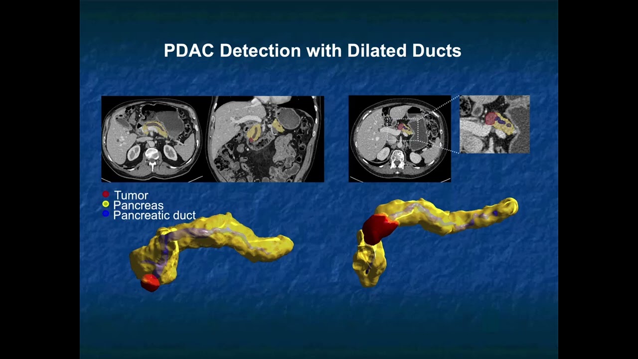 Artificial Intelligence (AI): Is It The End of Organized Radiology? - Part 1