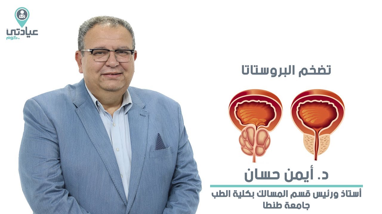 تضخم البروستاتا  مع أ.د / أيمن حسان _ دكتور مسالك بولية بطنطا