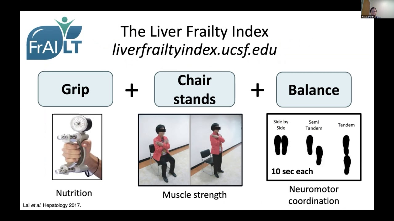 Frailty in Patients with Cirrhosis: From Recognition to Reversal, Presented by Jennifer Lai, MD, MBA
