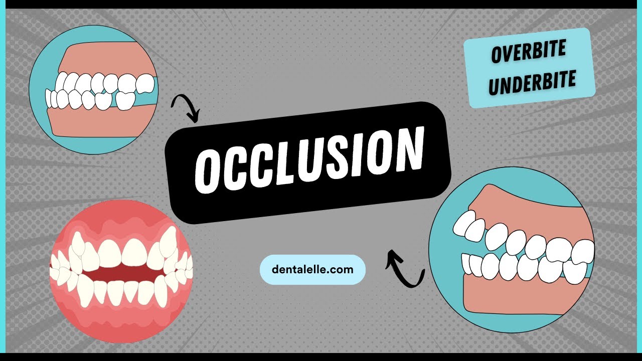 Explaining Dental Occlusion Types, Issues, and Treatments