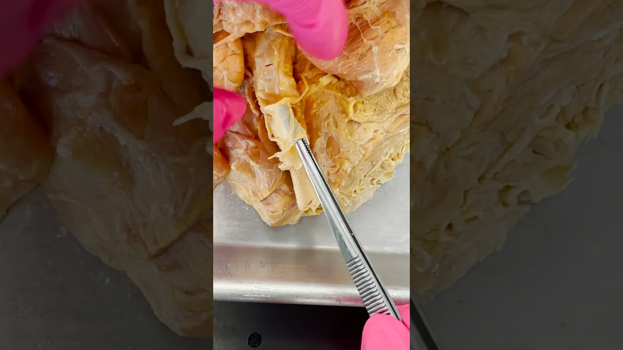 Amazing Demonstration of Arteries vs. Veins