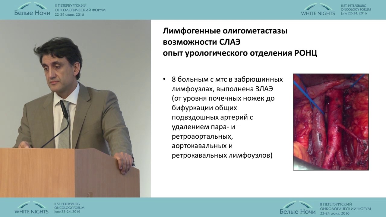 Лечение рецидивов рака простаты после радикальных методов терапии