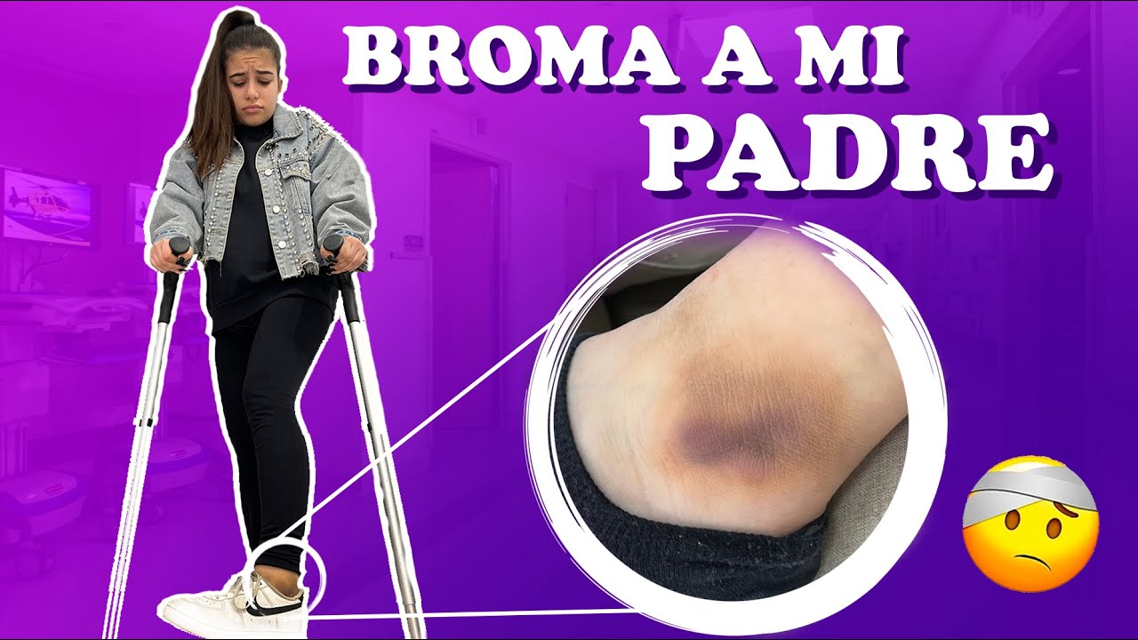 ME ROMPO UN PIE ! BROMA A MI PADRE 😂