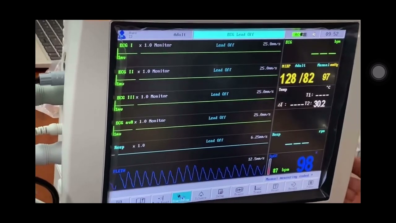 Vận hành Monitor Omni II - Công ty TPmed