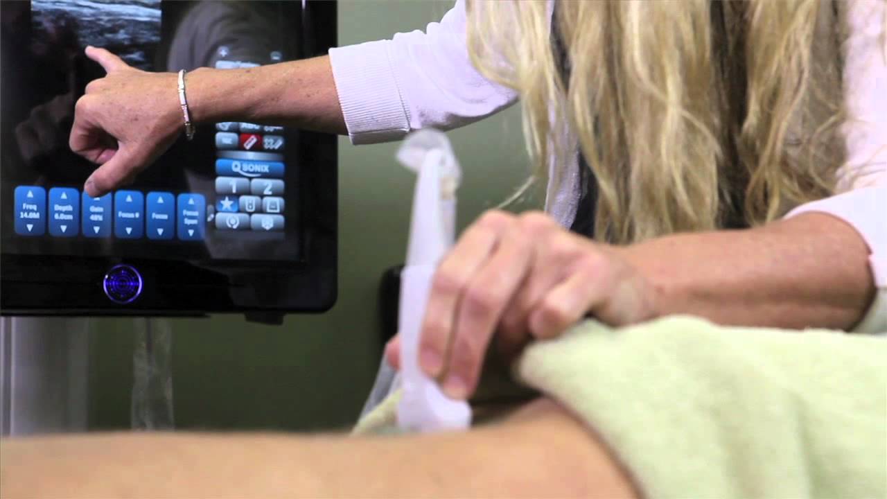 Ultrasound use for sports injuries in Peak Performance Physiotherapy Clinic