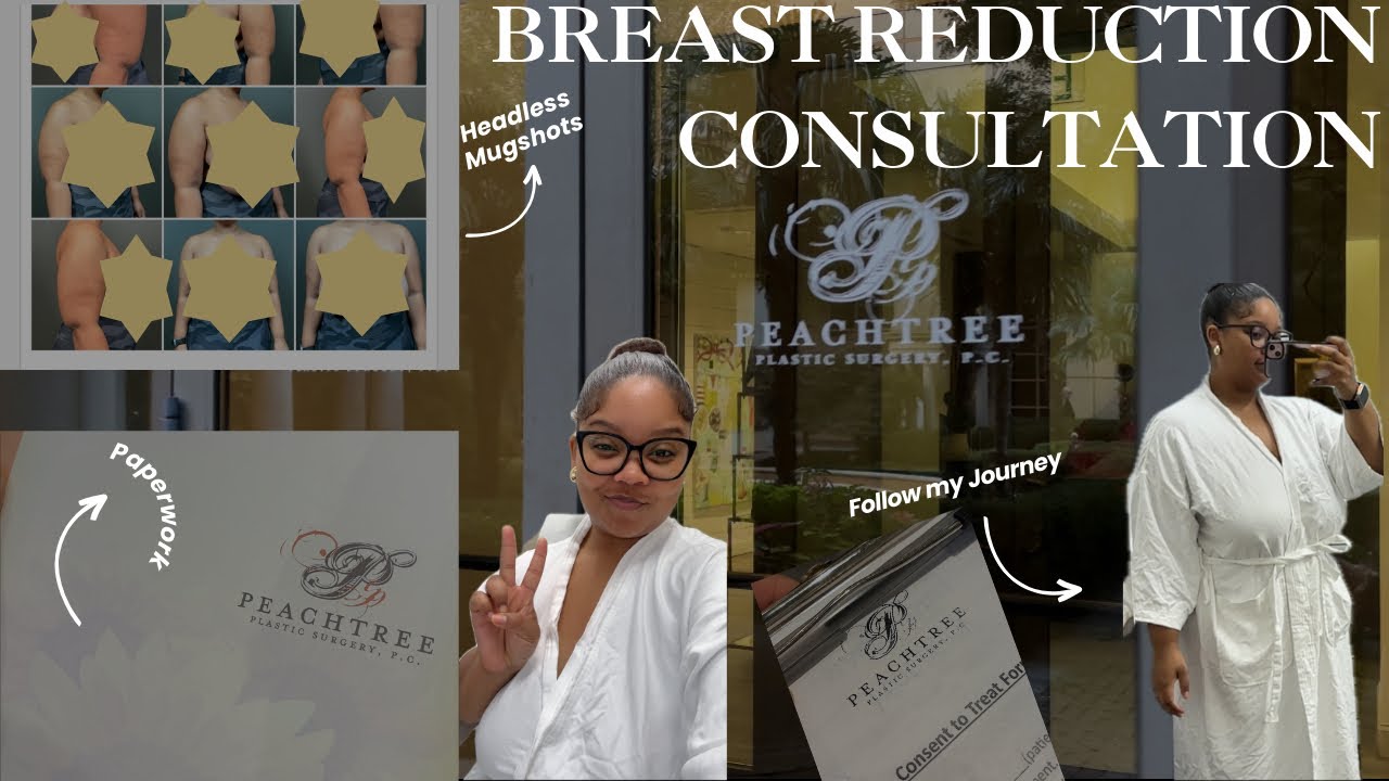 Breast Reduction Consultation: My First Step Towards Comfort & Confidence!