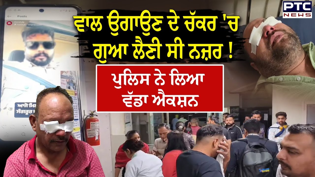 Sangrur Free Camp : ਗੰਜੇਪਨ ਤੋਂ ਛੁਟਕਾਰਾ ਪਾਉਣ ਦੇ ਚੱਕਰ 'ਚ ਹੋ ਚੱਲੇ ਸੀ 'ਅੰਨ੍ਹੇ' ! ਮੁਫ਼ਤ ਕੈਂਪ ਪਿਆ ਭਾਰੀ