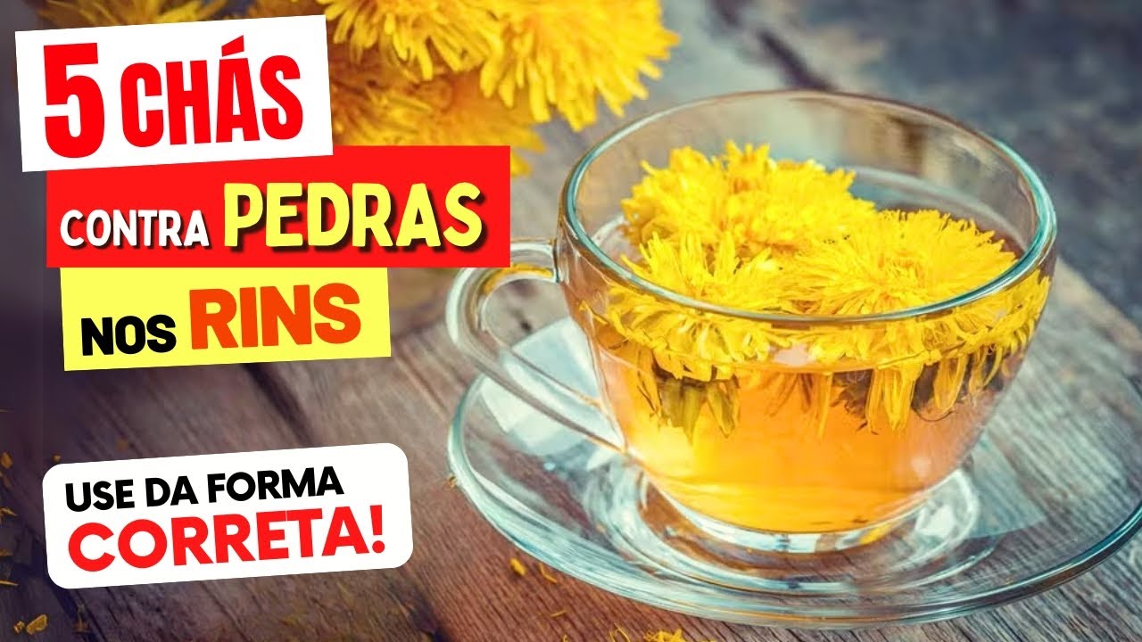 5 Melhores CHÁS contra PEDRA NOS RINS - Benefícios, Como Preparar e Como Tomar