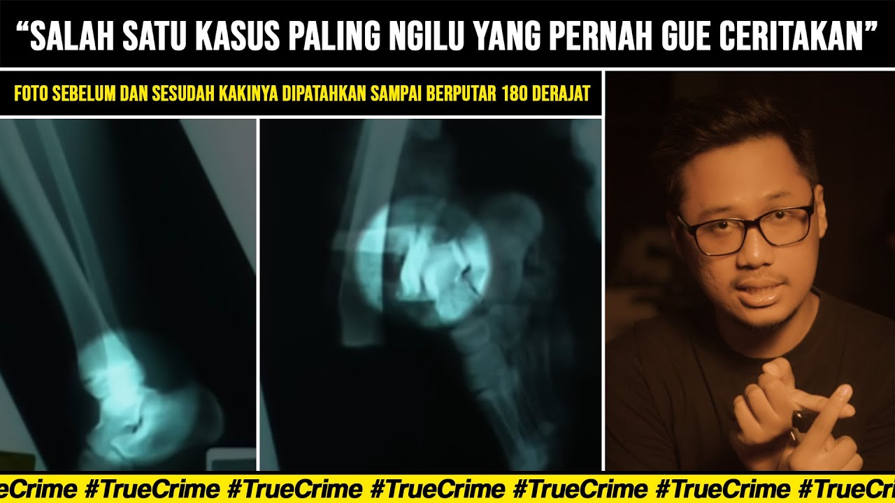 ORANG YANG SUKA MEMATAHKAN TULANG | Thadius Philips Joseph Clark