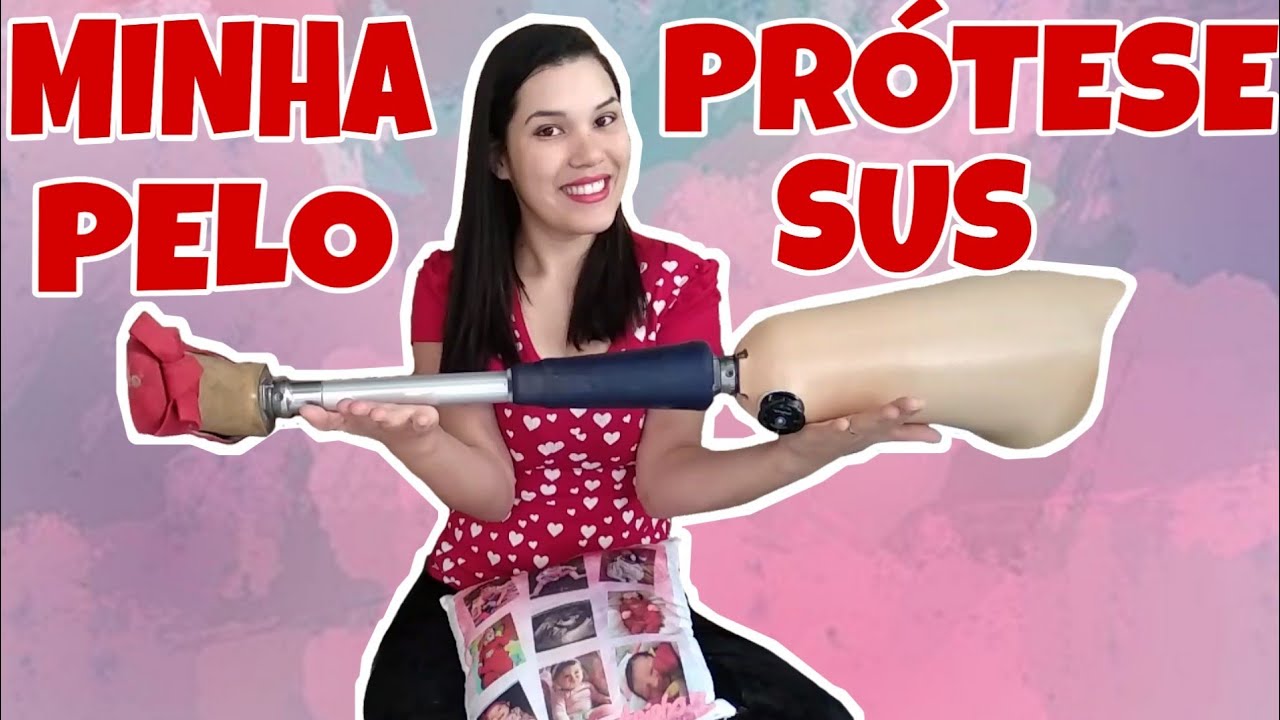 Minha PRÓTESE pelo SUS - perna mecânica - my mechanical leg